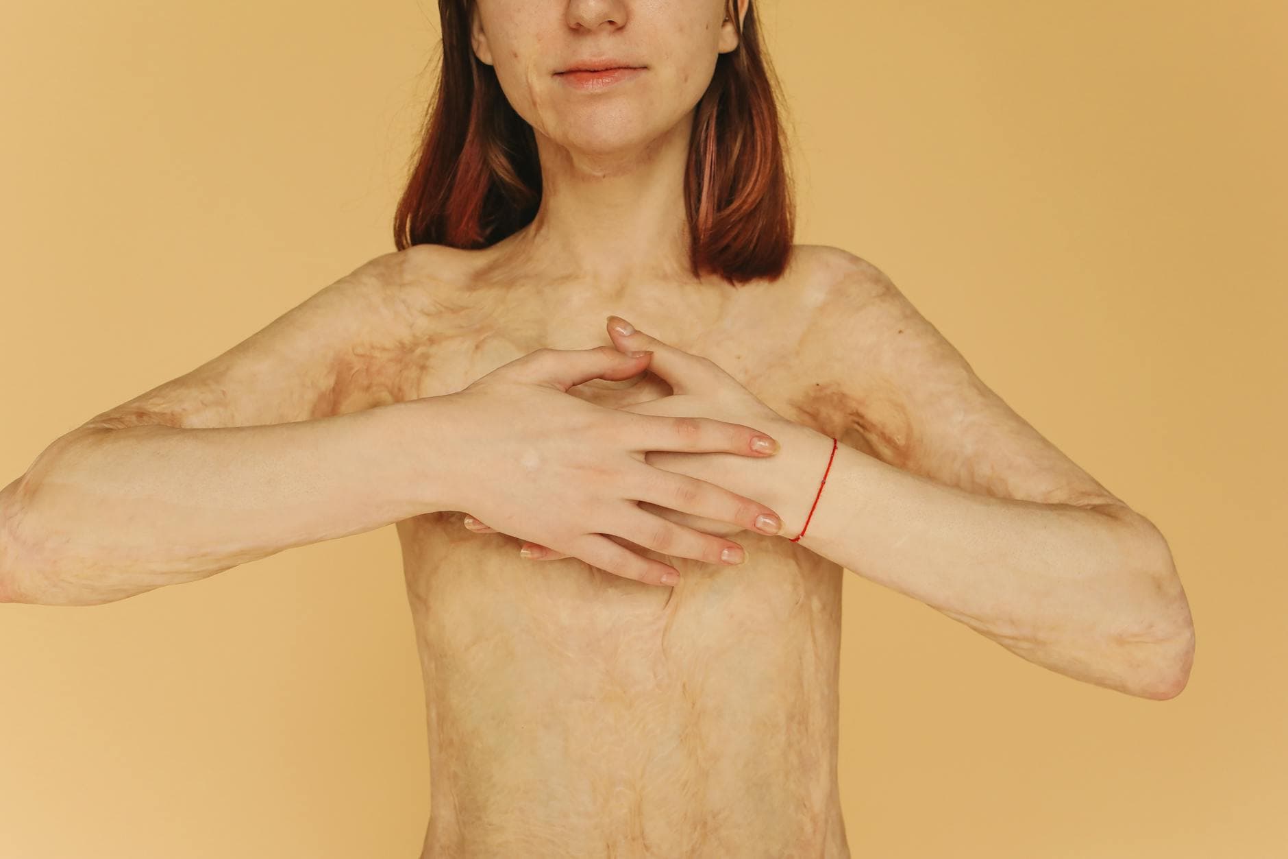 Empowering close-up portrait of a woman with burn scars on a yellow background. - trauma healing quotes
