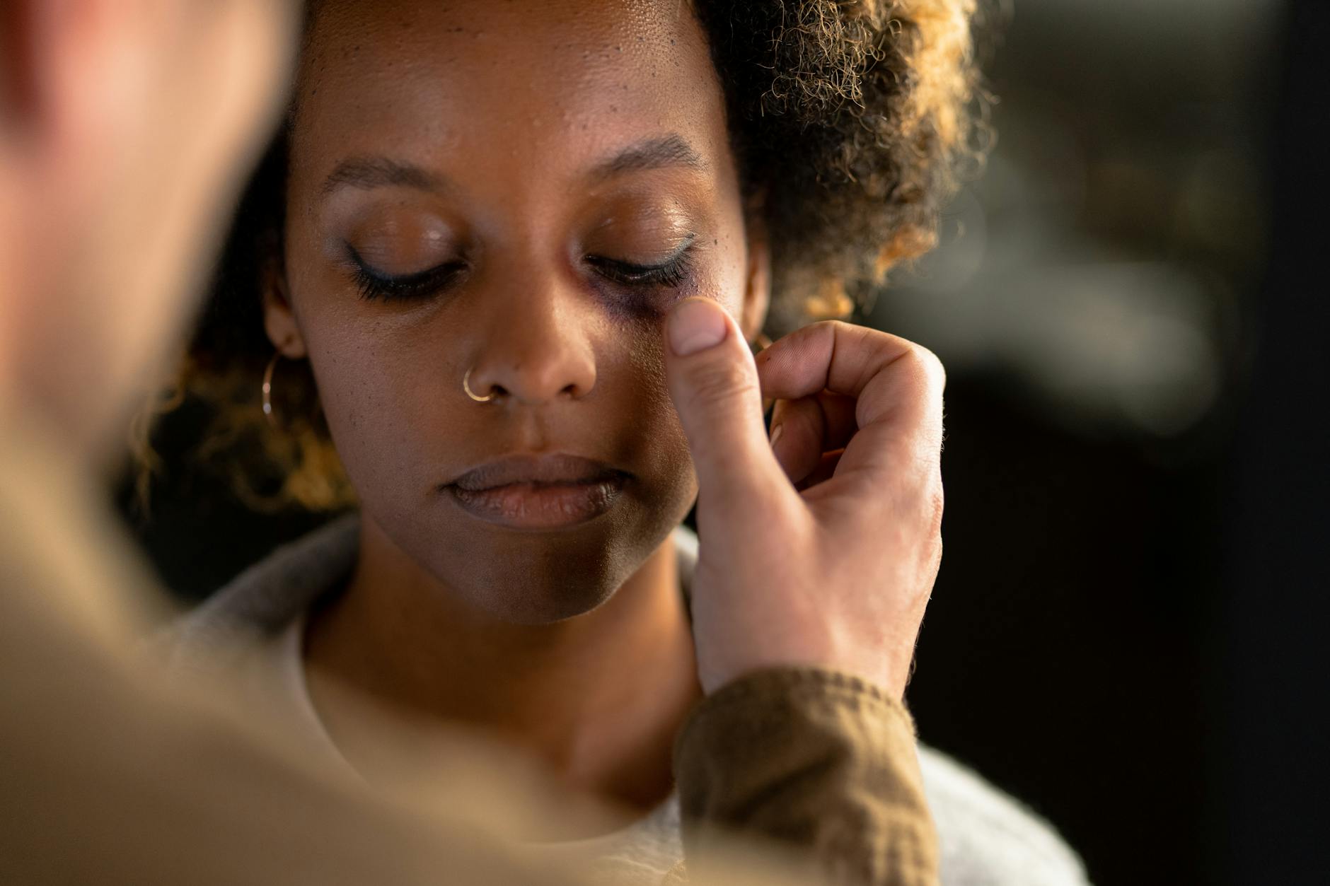 A person gently touches a woman's face with a visible bruise under her eye, showing concern. - relationship healing