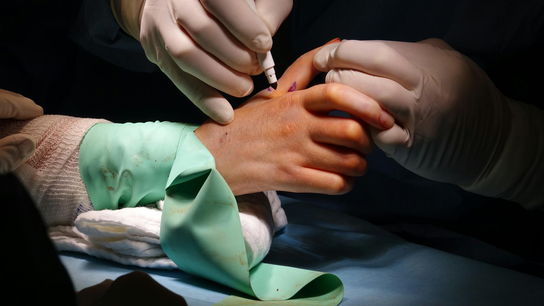 Close-up of surgeons performing a delicate wrist surgery in an operating room. - trauma healing quotes